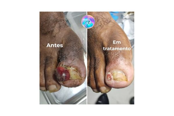 antes e depois 22 